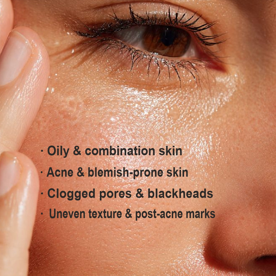 2% Salicylic Acid & 2% Mandelic Acid Anti Acne Serum